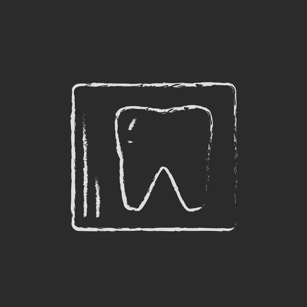 X-ışını tebeşirle çizilmiş diş simgesinin. — Stok Vektör