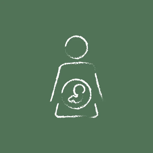 チョークで描かれた子宮アイコンの中の赤ちゃんの胎児. — ストックベクタ