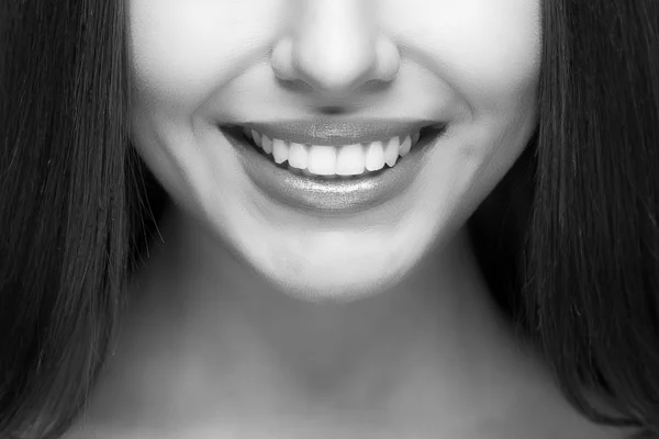 Un sourire de femme. Blanchiment des dents. Soins dentaires . — Photo