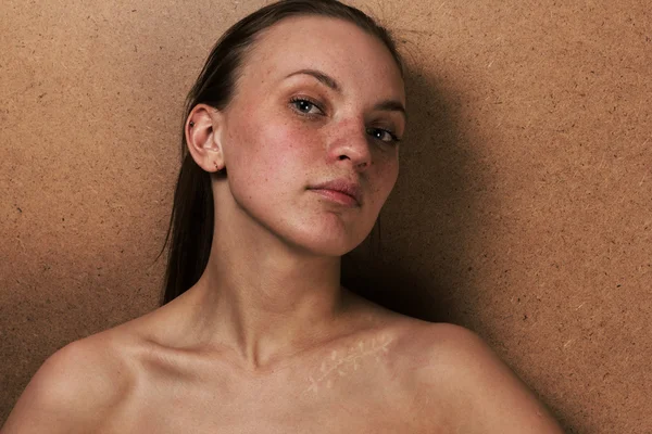 Closeup girl portrait with a scar on a clavicle — Stock Fotó