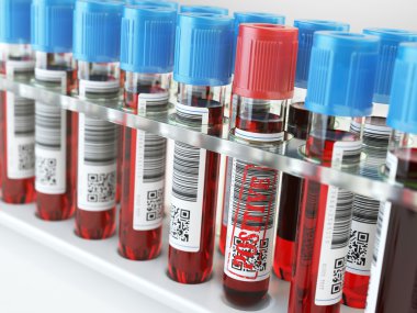Test tüpleri bir rafa kan kan örnek pozitif ve diğerleri