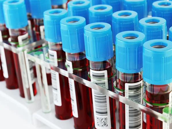 Kan test tüpleri. Kan örnekleri bir rafa. — Stok fotoğraf