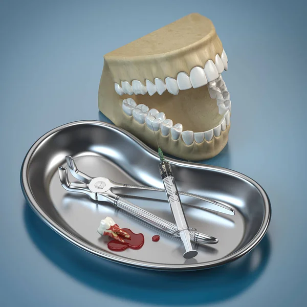 牙科护理和人体支撑模型的牙科医生工具 3D说明 — 图库照片
