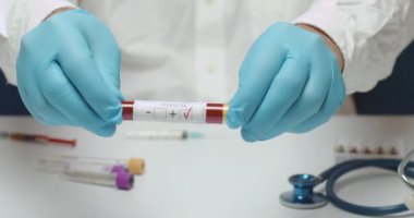 Analiz laboratuarının kapanışı bir hastanın 19 pozitif kan testi sonucunda yapılan kontroller sırasında yapılır. Test sonuçları test tüpünde yazıyor, doktor beyaz önlük ve mavi eldiven giyiyor.
