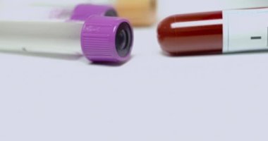 Test tüplerini kapatın ve covid-19 testinin sonucu pozitif çıksın. Kamera soldan sağa hareket ediyor.