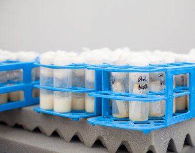 Test tüpleri görünümünü