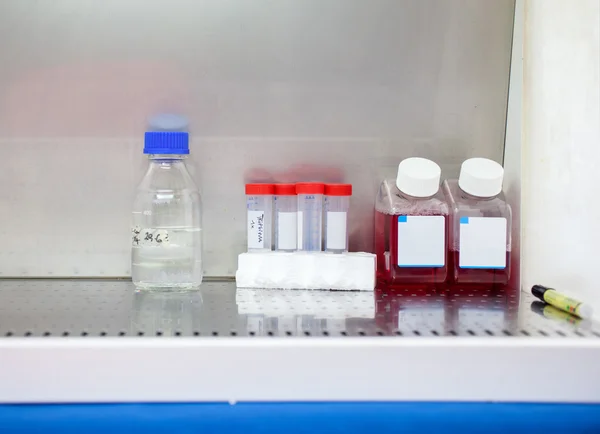 Close up of test Tubes — Stock Photo, Image