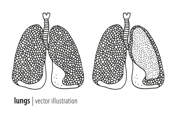 Illustration und Schnitt der Lungen — Stockvektor