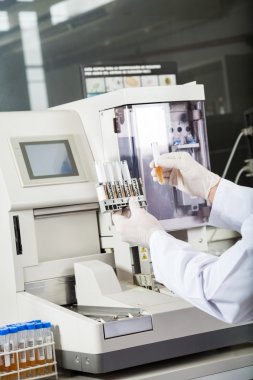 İdrar Analizörleri tarafından örnekleri inceleyerek araştırmacı