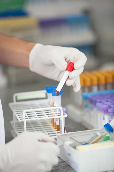 Technicus analyseren bloedmonster In laboratorium — Stockfoto
