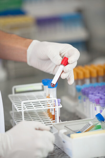 Technician Analyzing Blood Sample In Laboratory