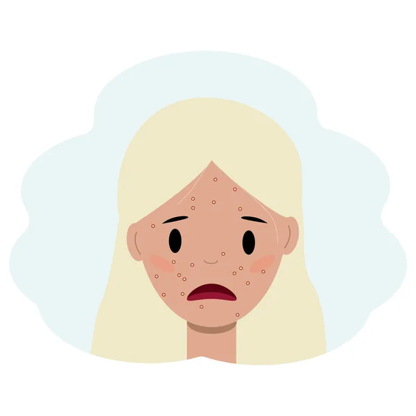にきびのある若い女性の顔のイラスト。フェイシャルスキンケアコンセプト — ストックベクタ