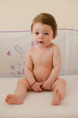  Roseola Infantum döküntü