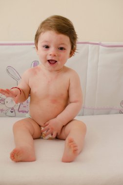  Roseola Infantum döküntü