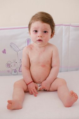  Roseola Infantum döküntü cilt