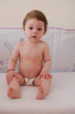  Roseola Infantum döküntü cilt