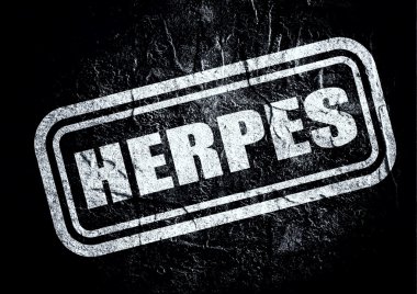 damga ile herpes metnin grunge arka plan üzerinde