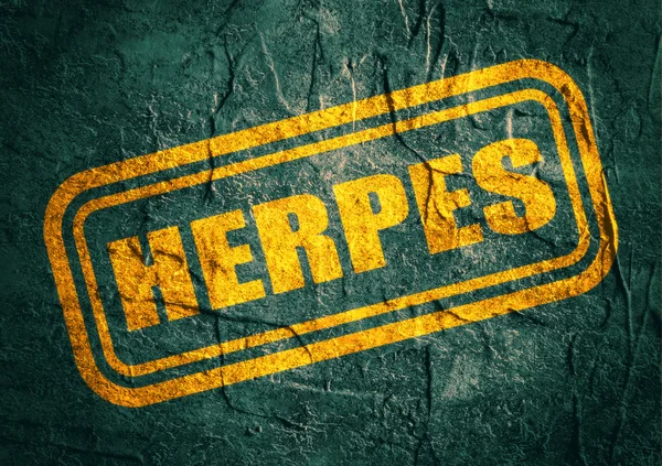 Stämpel med herpes text över grunge bakgrund — Stockfoto