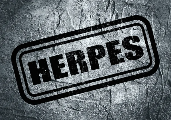 Timbro con testo herpes su sfondo grunge — Foto Stock