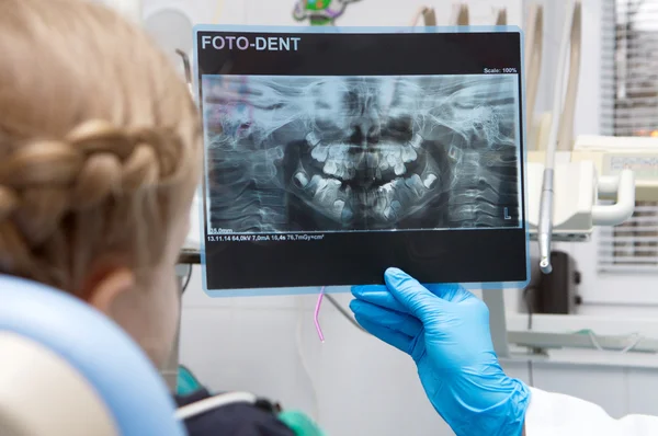 Doktor zobrazeno baby foto dent — Stock fotografie