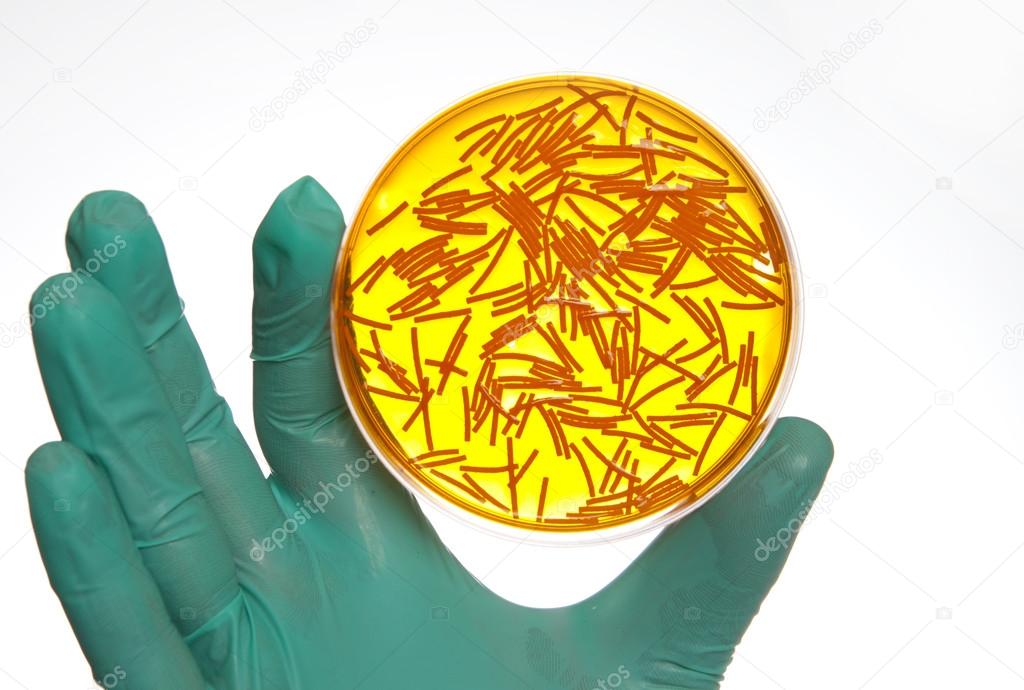 Petri dish with virus cells