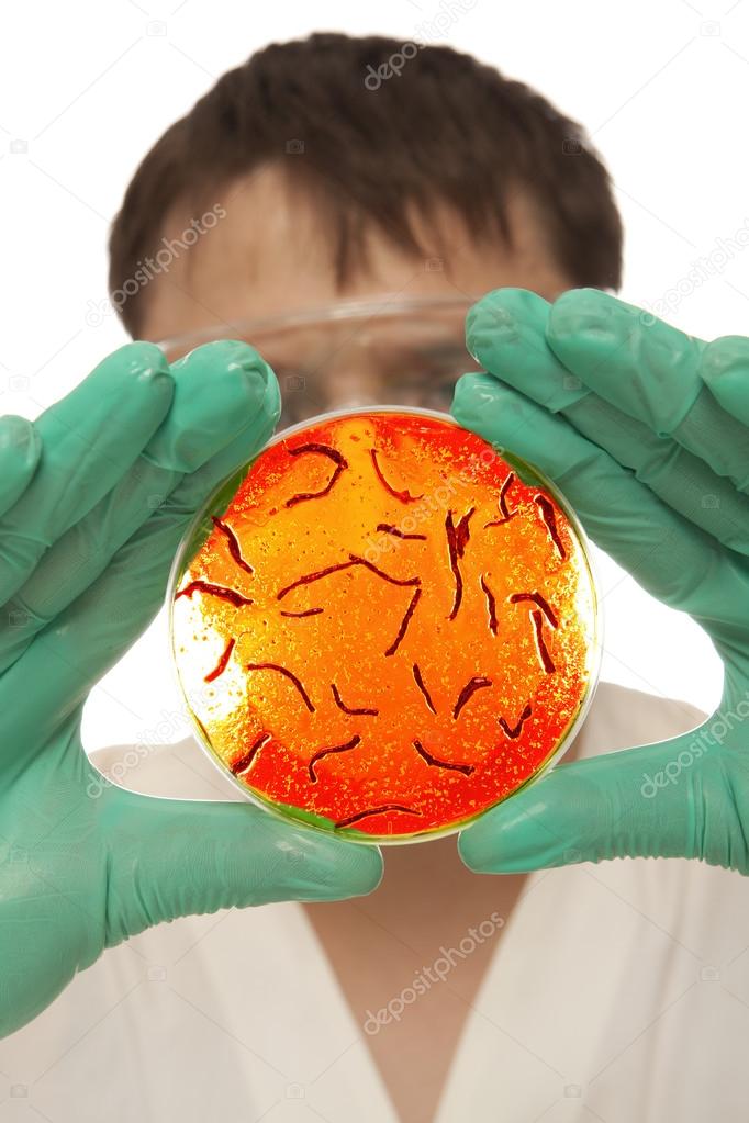 Petri dish with virus cells