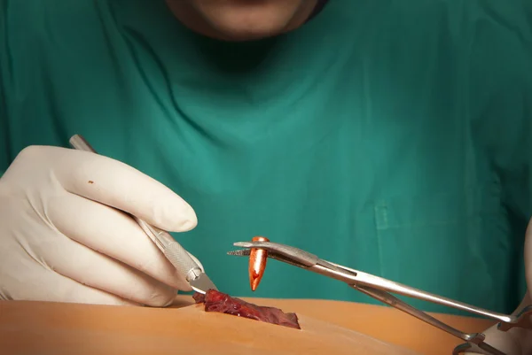 Un cirujano sostiene una bala ensangrentada — Foto de Stock