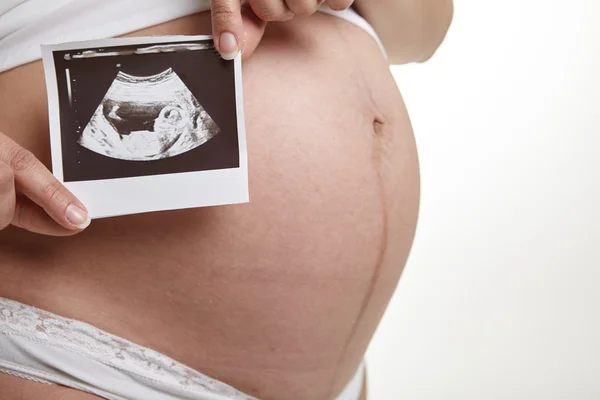 Lindo vientre embarazada — Foto de Stock