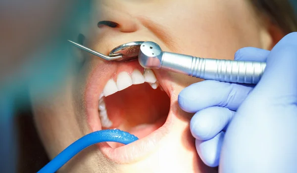 Woman getting a dental treatment — Stock Photo, Image