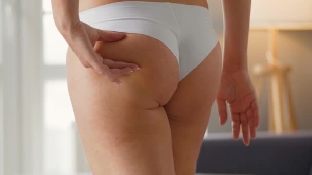 Donna che comprime la pelle dei glutei e dei lati controllando la cellulite e il grasso sottocutaneo in eccesso — Video Stock