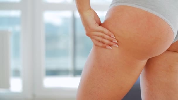 Vrouw die de huid van de billen comprimeert en controleert op cellulitis en overtollig onderhuids vet — Stockvideo