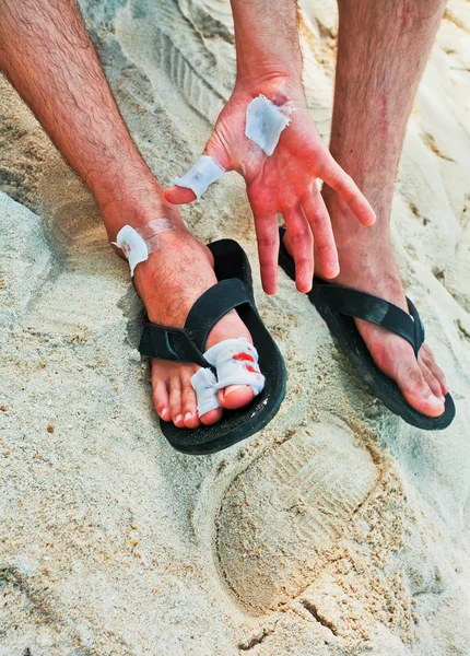 Ferimento dei piedi e della mano — Foto Stock