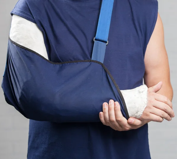 Mann mit Gips — Stockfoto