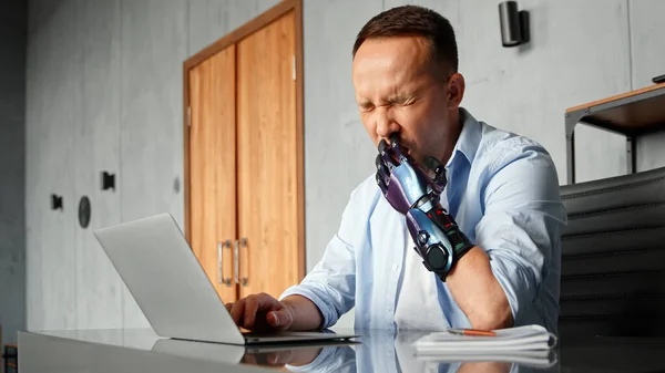 Behinderter Programmierer mit Bio-Hand-Hightech-Prothese löst Tippfehler auf Laptop — Stockfoto