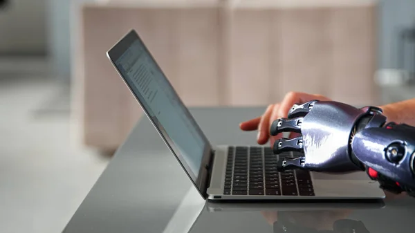 Prótese de bio membro preto e mão saudável aparecem sobre laptop e tipo no teclado sob luz solar brilhante — Fotografia de Stock