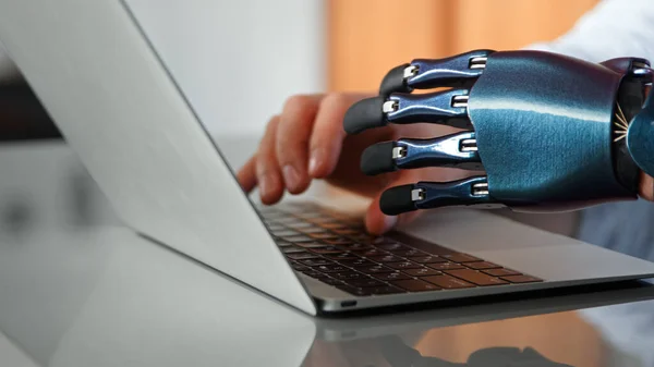 Programador hombre manos con tipo de prótesis bio artificial en el teclado portátil en la mesa bajo la luz del sol brillante Fotos De Stock