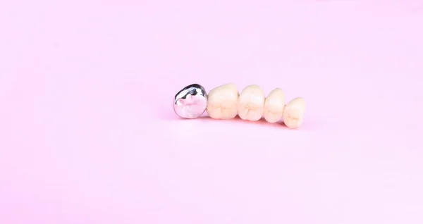 Prótese dentária em fundo rosa — Fotografia de Stock