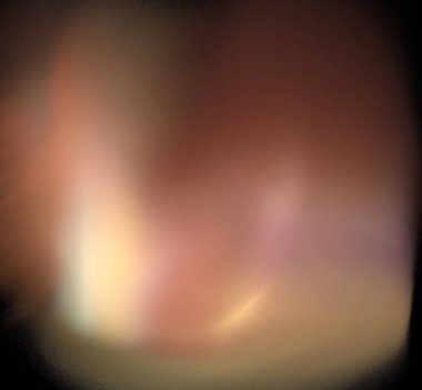 Dijital fraktal resimlerinden birinin resmi