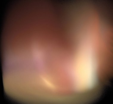 Dijital fraktal resimlerinden birinin resmi