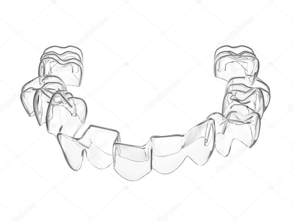 3d renderizado de alineador extraíble invisalign enderezar los dientes