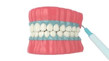 Beyaz arka planda profesyonel diş beyazlatma işlemi