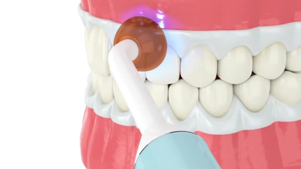白い背景の上にランプで白くプロの歯 異なるタイプのホワイトニング歯の概念 — ストック動画