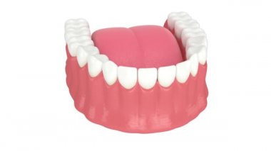 Dişeti durgunluğu olan düşük çene