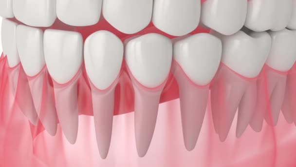 歯の割れのプロセスを持つ人間の顎 — ストック動画