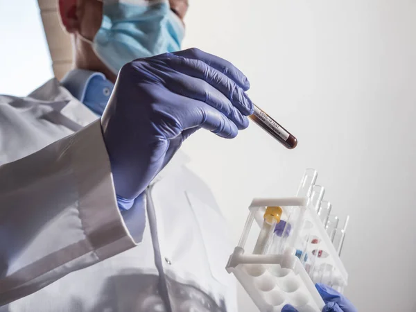 Médico Con Máscara Guantes Comprueba Tubo Ensayo Análisis Covid — Foto de Stock