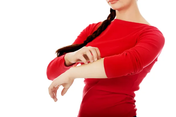 Молодая женщина чешет руку — стоковое фото