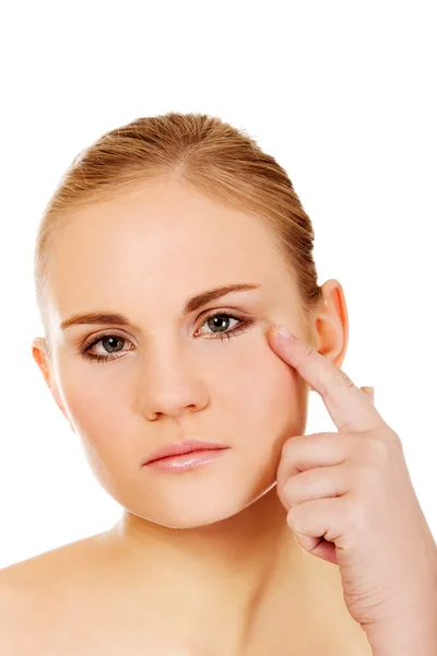 Unhappy young woman touching her pimple — Stock Photo, Image