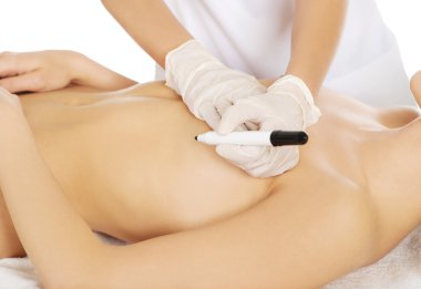 Genç kadın meme ameliyatından önceki.