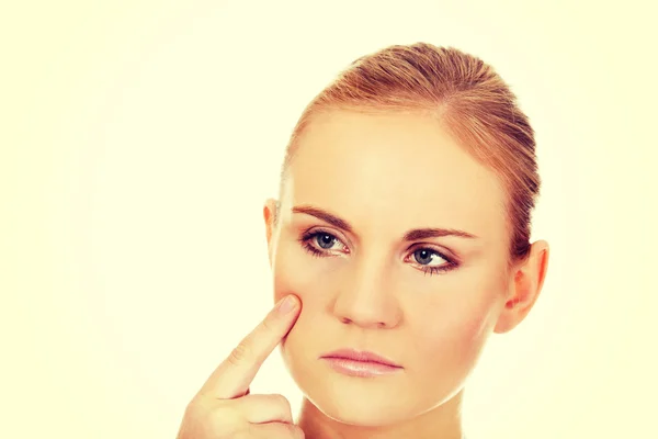 Unhappy young woman touching her pimple — Stock Photo, Image