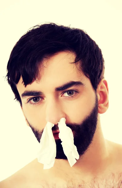 Uomo malato con i tessuti nel naso . — Foto Stock